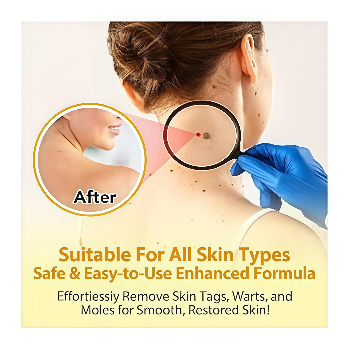 Fade Moles & Spots: Gentle Cream for Flawless, Radiant Skin