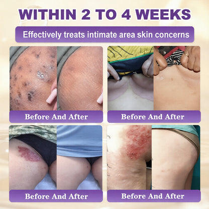 Made and Shipped from USA Lumivo® Biotin 10-in-1 Skin Restoration Cream