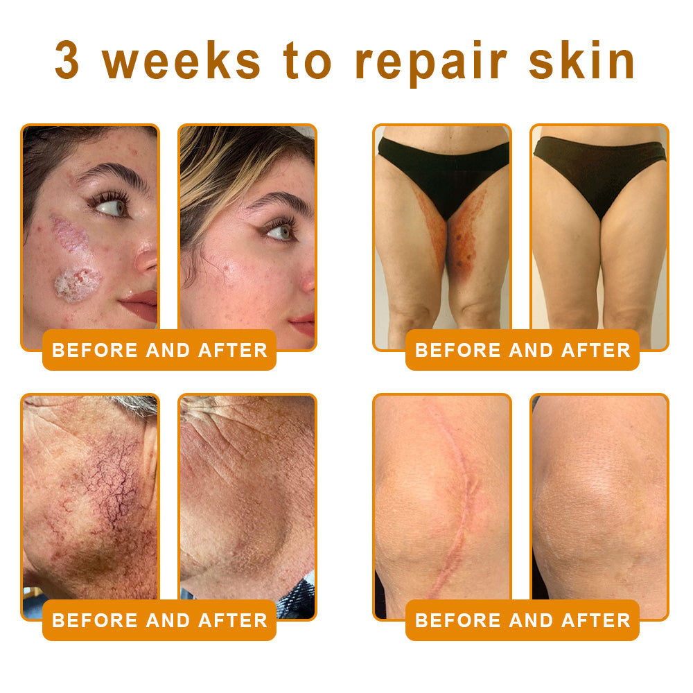 LUMIVO™ Advanced Bee Venom Skin Restoration Cream 🐝 (🔥EXCLUSIVE OFFER - 80% OFF TODAY ONLY) ✨👩‍🔬