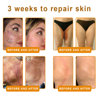 LUMIVO™ Advanced Bee Venom Skin Restoration Cream 🐝 (🔥EXCLUSIVE OFFER - 80% OFF TODAY ONLY) ✨👩‍🔬