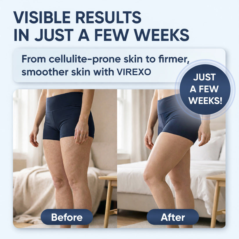 Virexo® SculptGlow™ – Firmer, More Toned Skin