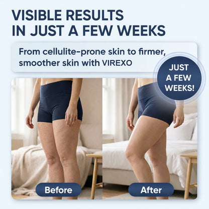 Virexo® SculptGlow™ – Firmer, More Toned Skin