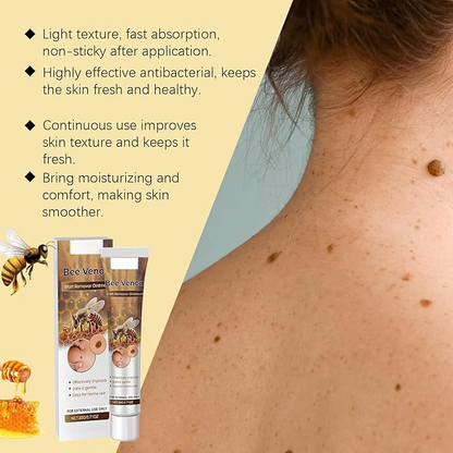Fade Moles & Spots: Gentle Cream for Flawless, Radiant Skin