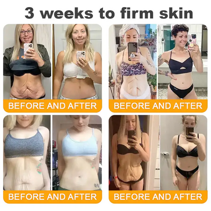 LUMIVO™  Bee Poison Skin Restoration Cream 👨‍⚕️（🔥LAST DAY SALE-80% OFF)🥇👩‍⚕️