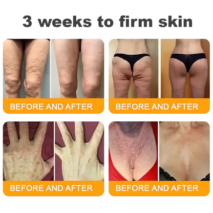 LUMIVO™ Advanced Bee Venom Skin Restoration Cream 🐝 (🔥EXCLUSIVE OFFER - 80% OFF TODAY ONLY) ✨👩‍🔬