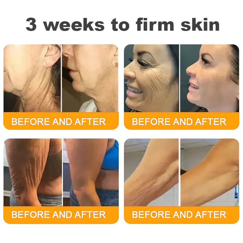 LUMIVO™  Bee Poison Skin Restoration Cream 👨‍⚕️（🔥LAST DAY SALE-80% OFF)🥇👩‍⚕️