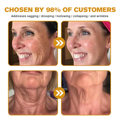 LUMIVO™  Bee Poison Skin Restoration Cream 👨‍⚕️（🔥LAST DAY SALE-80% OFF)🥇👩‍⚕️