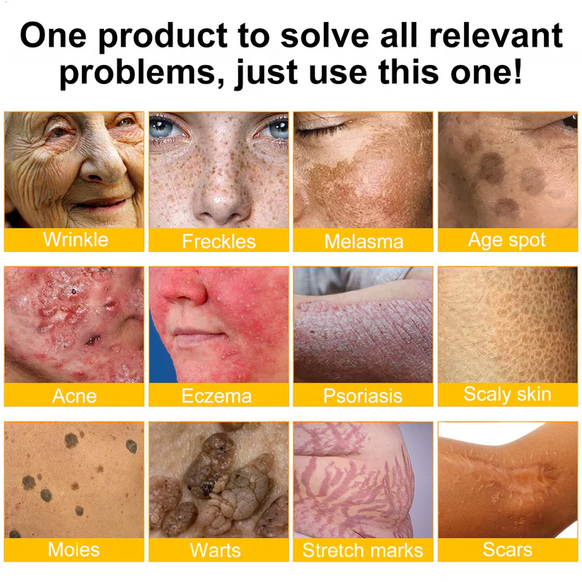 LUMIVO™  Bee Poison Skin Restoration Cream 👨‍⚕️（🔥LAST DAY SALE-80% OFF)🥇👩‍⚕️