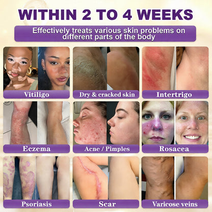 Made and Shipped from USA Lumivo® Biotin 10-in-1 Skin Restoration Cream