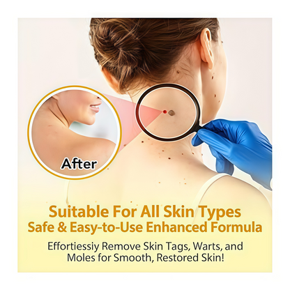 Fade Moles & Spots: Gentle Cream for Flawless, Radiant Skin
